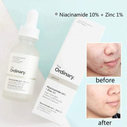 Ordinary Serum Niacinamide 10% + Zinc 1% 30ml